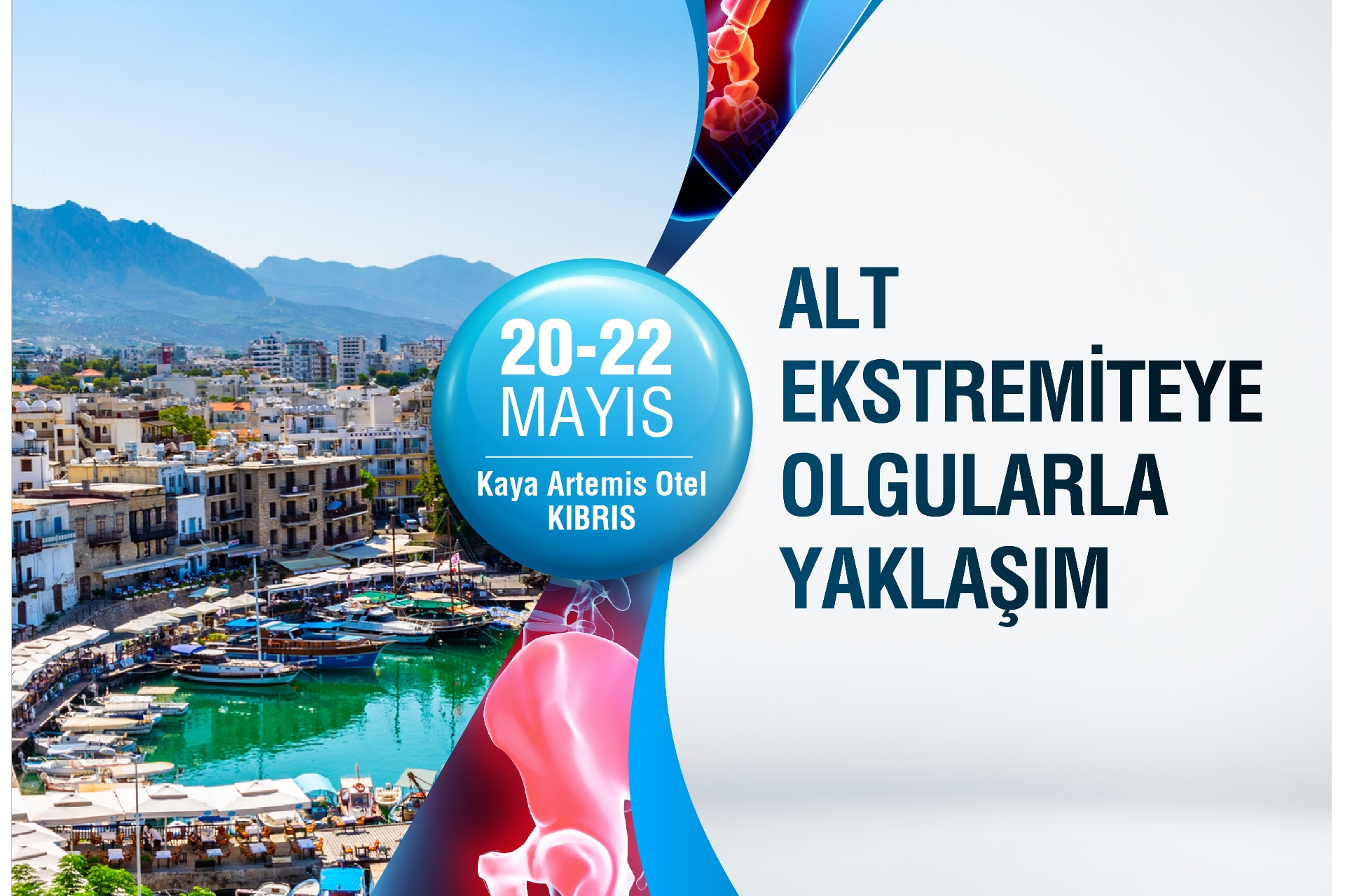 Alt Ekstremiteye Olgularla Yaklaşım